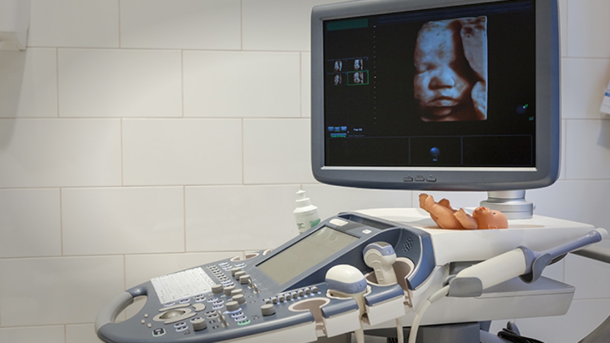 ultrasound